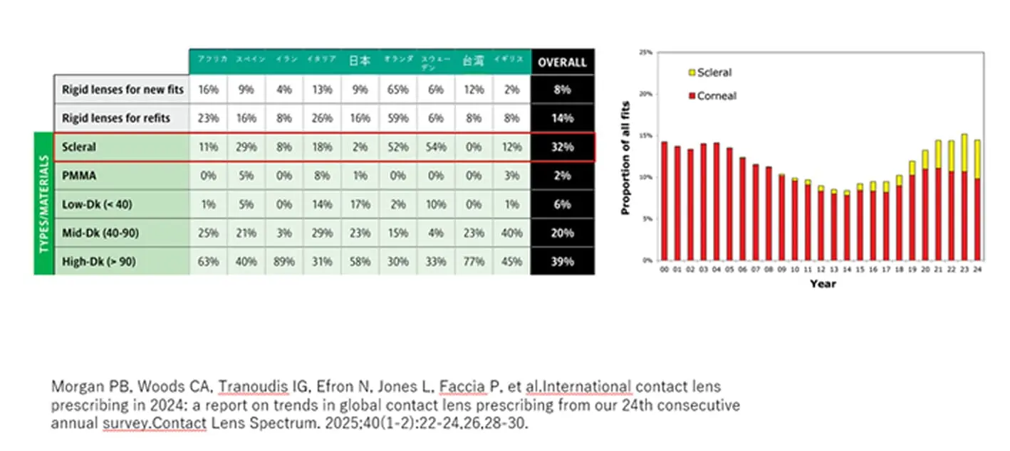 強膜レンズ　ビューノの様子