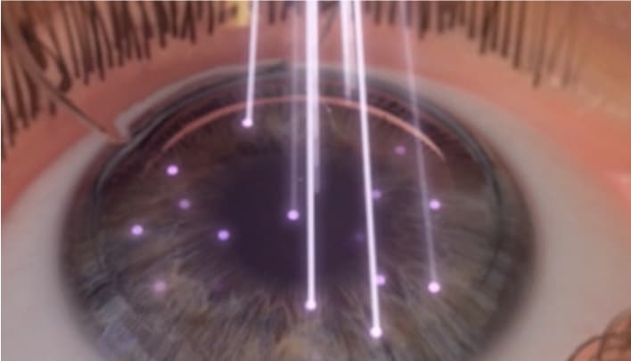 Advanced Eye Tracking Systemのイメージ