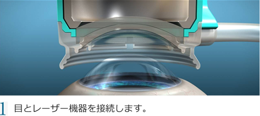 1 目を固定するリングを目をのせます